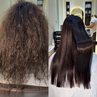 Nanoplasty — before (left) and after (right)